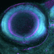 Zebrafish eye